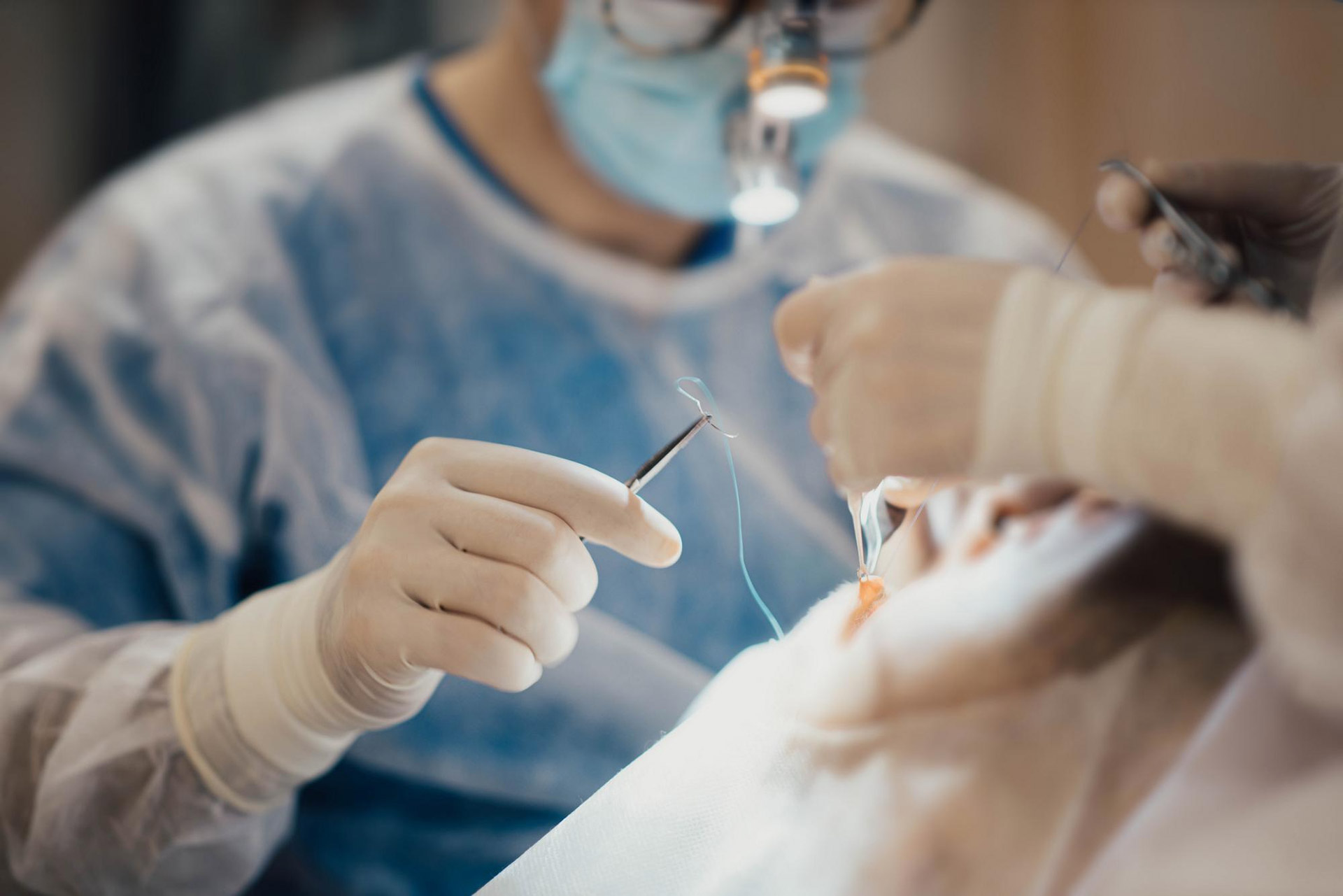 Dental Sutures