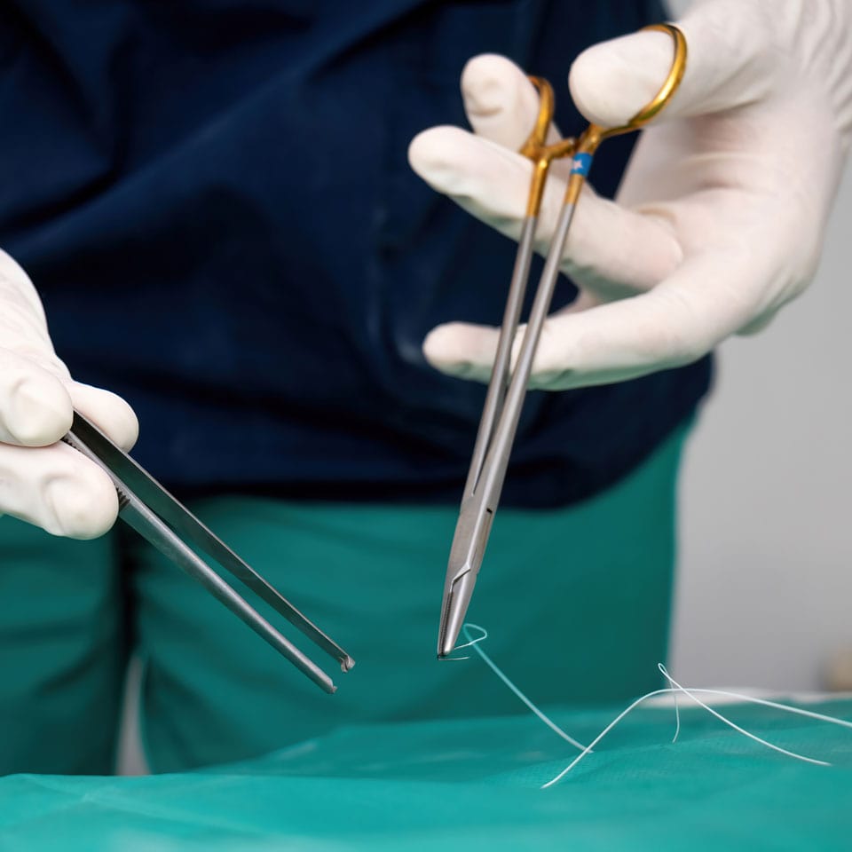 Multi-Purpose Surgical Sutures