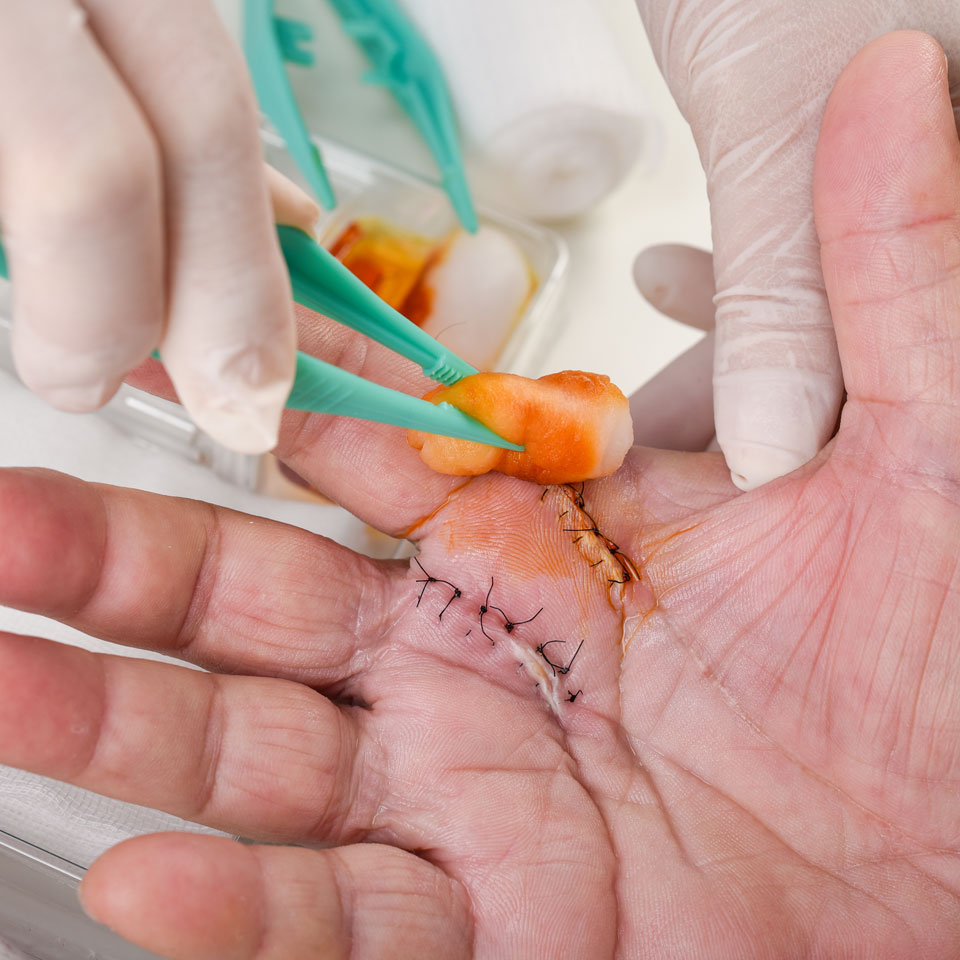 Scar & General Wound Care